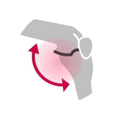Loss of flexibility Loss of flexibility