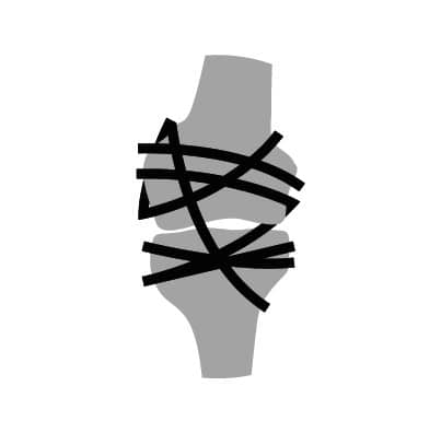 Stiffness Stiffness
